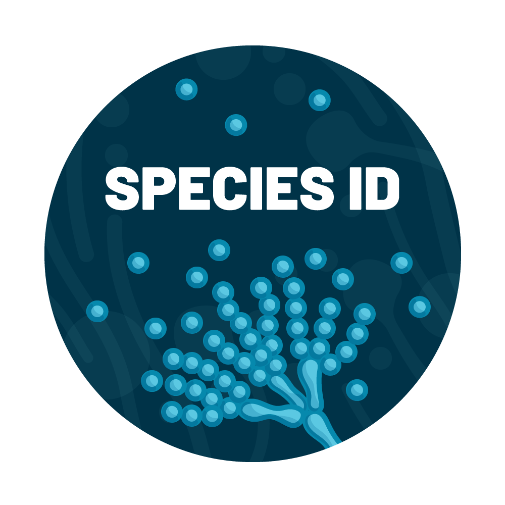 Fusarium Species Identification Water Test